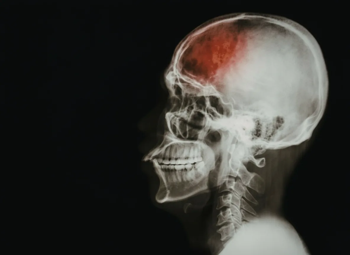 Brain Injury attorney in Kansas City, Dougherty and Holloway